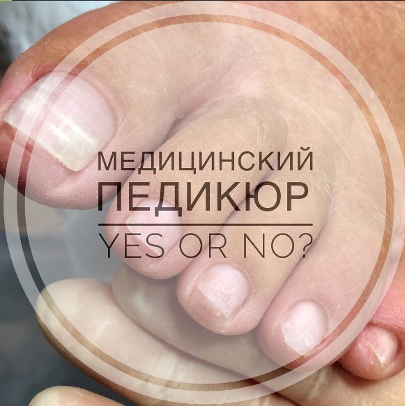Медицинский педикюр